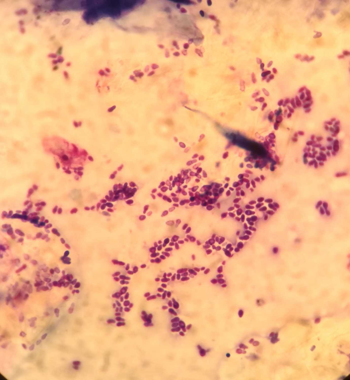 both ear cytology samples showing yeast overgrowth