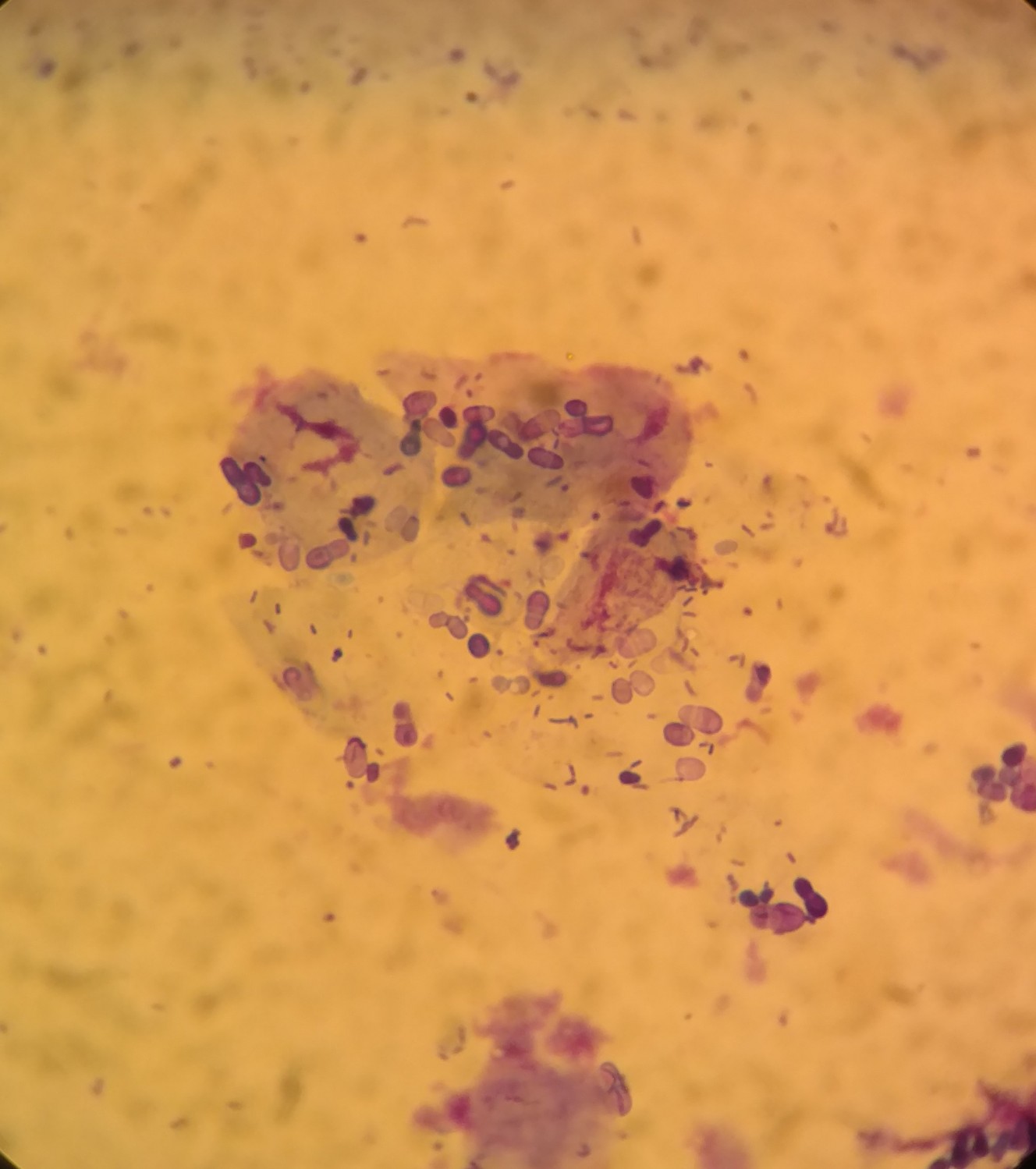 both ear cytology samples showing yeast overgrowth